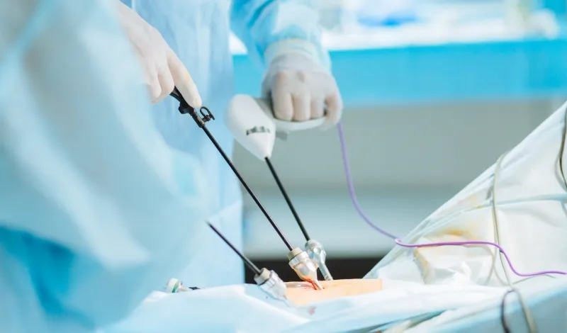 腹腔鏡手術について